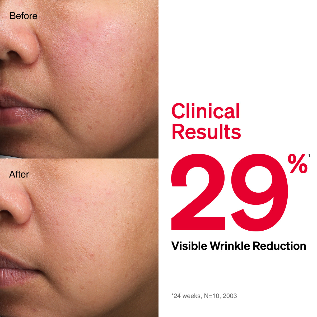 InnerSignal Rejuvenate Extract 14-Day Trial Kit